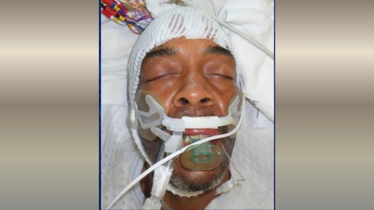 Hospital Seeks Public’s Help to Identify Unconscious Man Found in Downtown Los Angeles