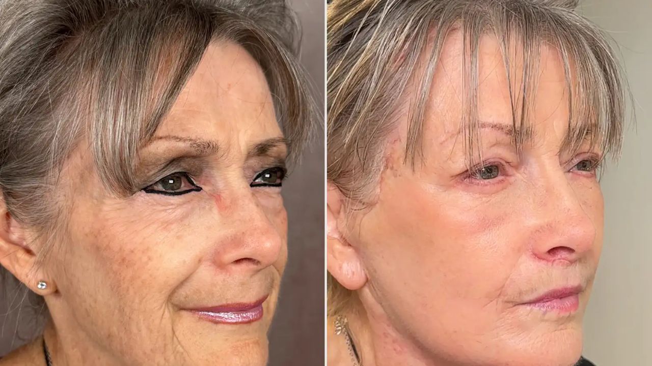 California Grandmother, 70, Shocks Social Media with '30-Year' Viral Transformation