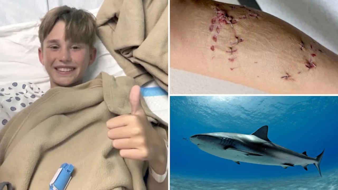 Texas Teen Saves Brother From Bahamas Shark Attack